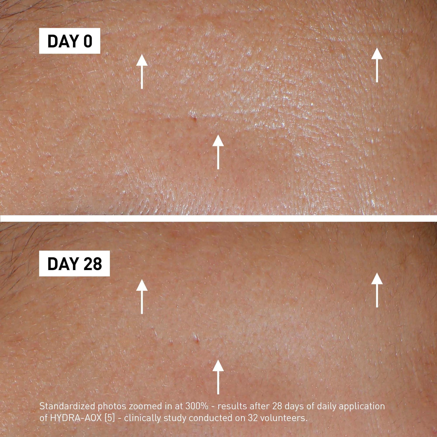 Hydra AOX (5) Intensive Serum – 30 ml