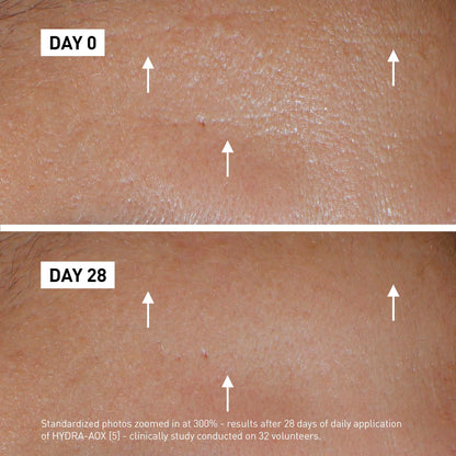Hydra AOX (5) Intensive Serum – 30 ml